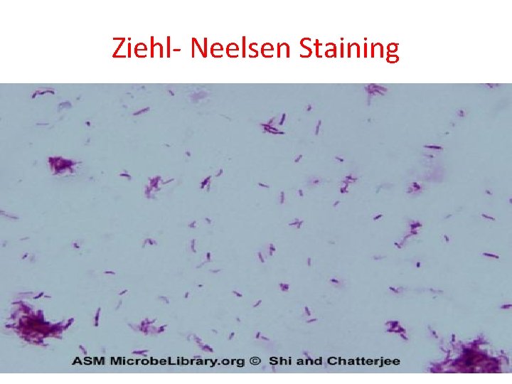 Ziehl- Neelsen Staining 