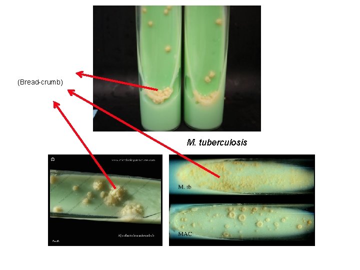 (Bread-crumb) M. tuberculosis 