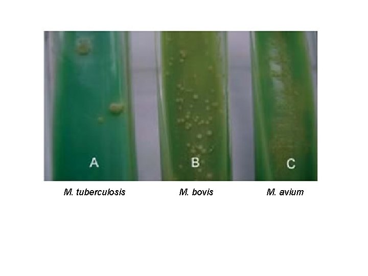 M. tuberculosis M. bovis M. avium 