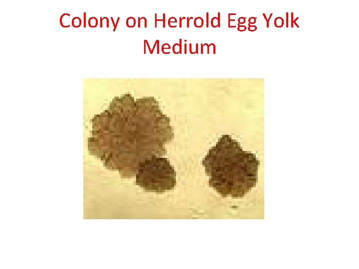 Colony on Herrold Egg Yolk Medium 