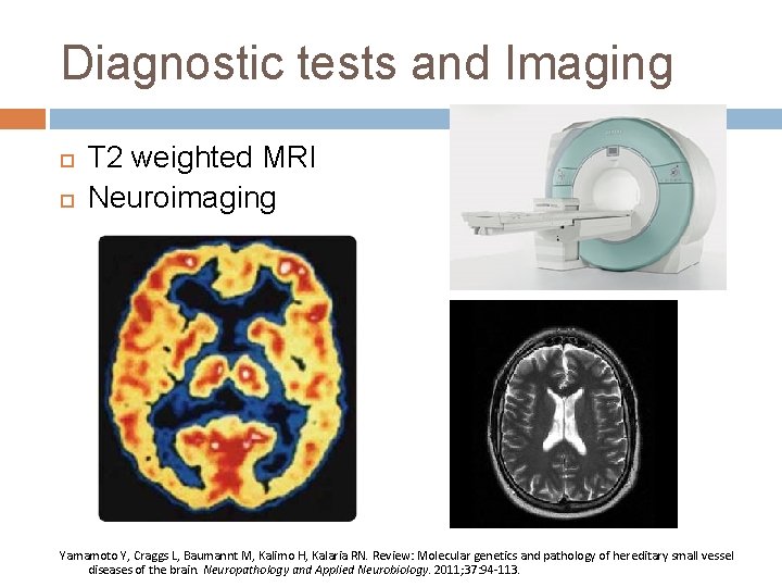 Diagnostic tests and Imaging T 2 weighted MRI Neuroimaging Yamamoto Y, Craggs L, Baumannt