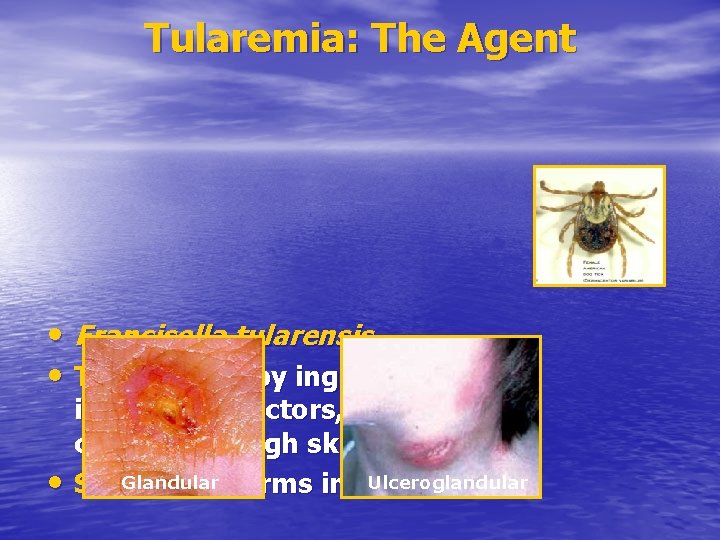 Tularemia: The Agent • Francisella tularensis • Transmitted by ingestion, • inhalation, vectors, direct