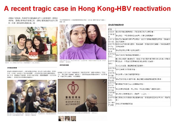 A recent tragic case in Hong Kong-HBV reactivation 