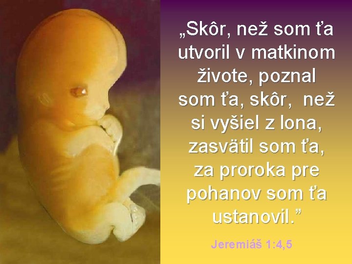 „Skôr, než som ťa utvoril v matkinom živote, poznal som ťa, skôr, než si