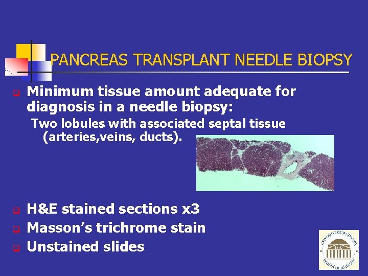 PANCREAS TRANSPLANT NEEDLE BIOPSY q Minimum tissue amount adequate for diagnosis in a needle