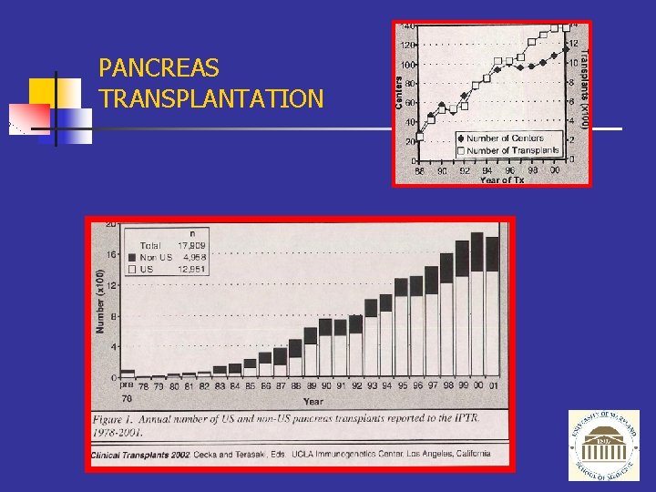 PANCREAS TRANSPLANTATION 