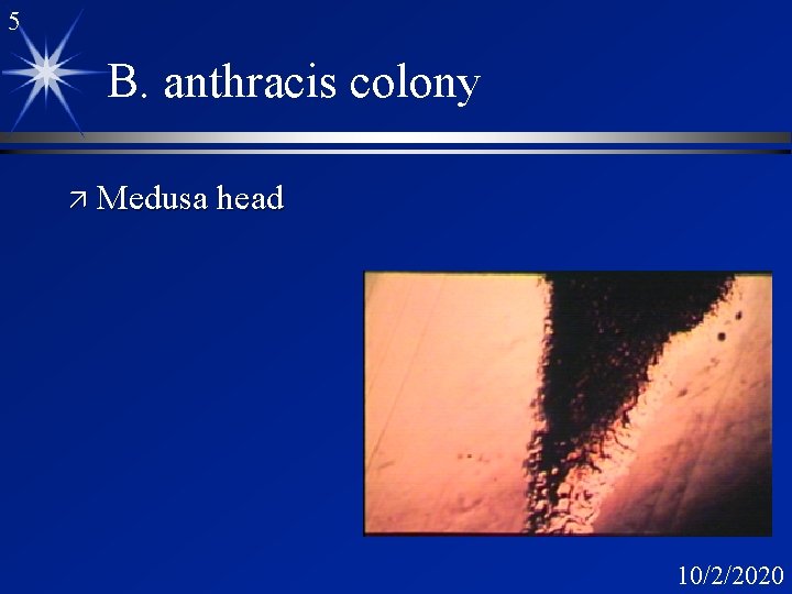 5 B. anthracis colony ä Medusa head 10/2/2020 