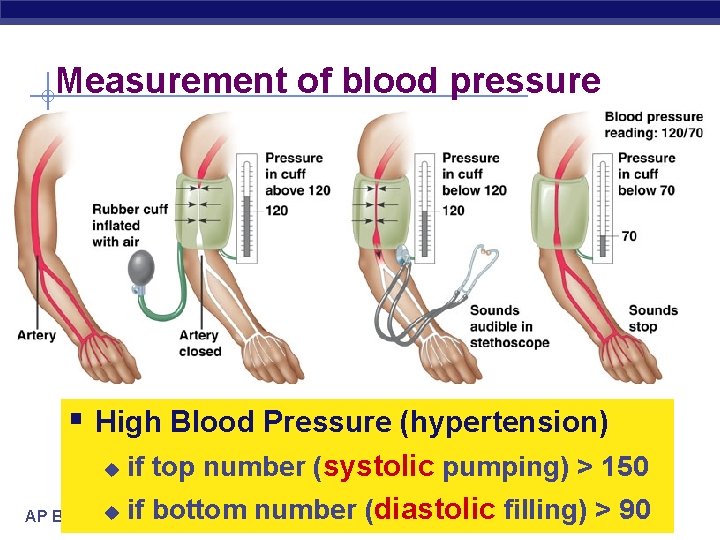 Measurement of blood pressure § High Blood Pressure (hypertension) u if top number (systolic