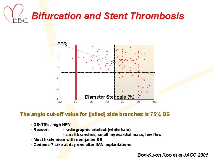Bifurcation and Stent Thrombosis FFR Diameter Stenosis (%) The angio cut-off value for (jailed)