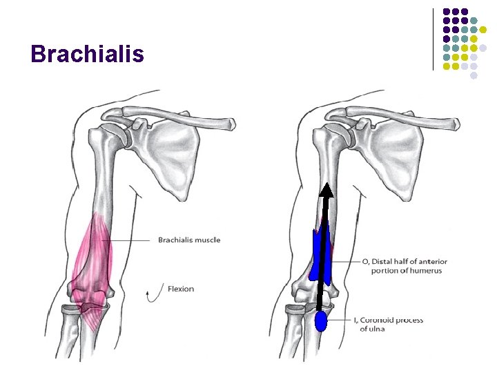 Brachialis 