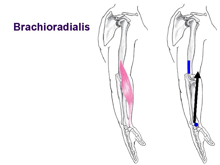Brachioradialis 