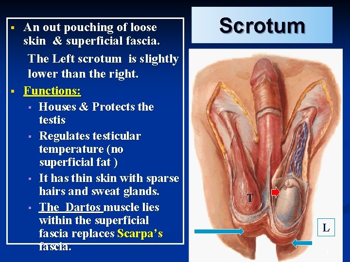§ § An out pouching of loose skin & superficial fascia. The Left scrotum