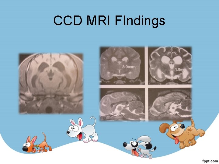 CCD MRI FIndings 