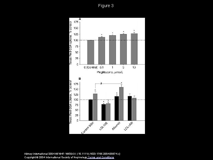 Figure 3 Kidney International 2004 651647 -1653 DOI: (10. 1111/j. 1523 -1755. 2004. 00574.