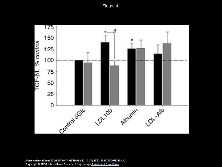 Figure 4 Kidney International 2004 651647 -1653 DOI: (10. 1111/j. 1523 -1755. 2004. 00574.