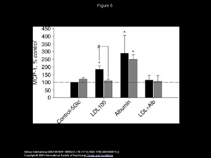 Figure 5 Kidney International 2004 651647 -1653 DOI: (10. 1111/j. 1523 -1755. 2004. 00574.