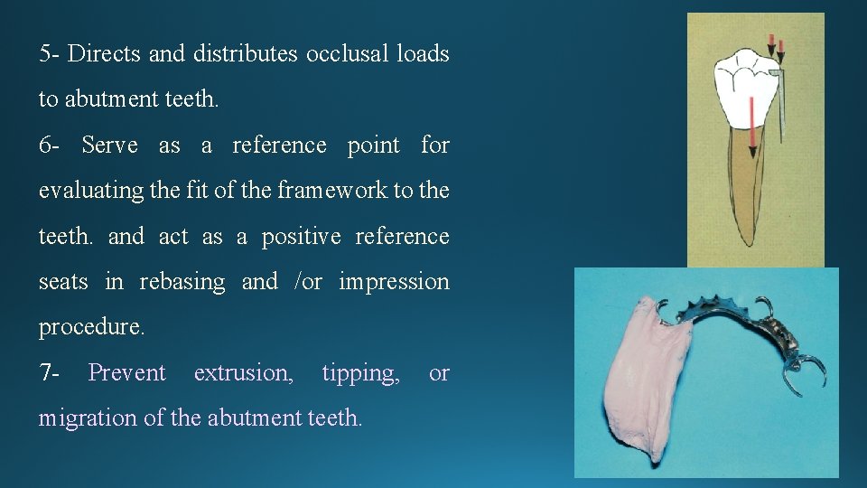 5 - Directs and distributes occlusal loads to abutment teeth. 6 - Serve as