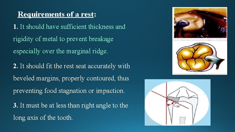 Requirements of a rest: 1. It should have sufficient thickness and rigidity of metal