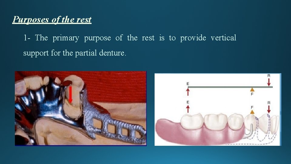 Purposes of the rest 1 - The primary purpose of the rest is to