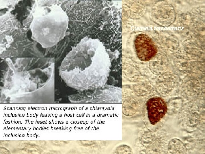 Clamidia trachomatis 