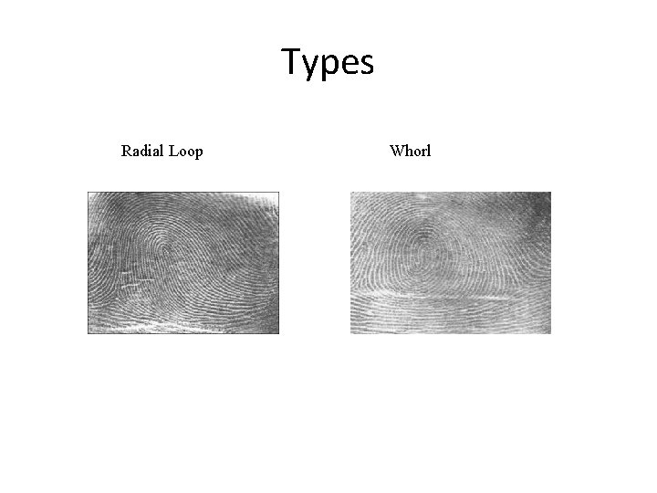 Types Radial Loop Whorl 