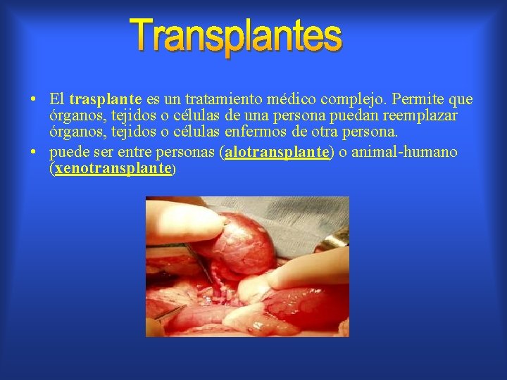  • El trasplante es un tratamiento médico complejo. Permite que órganos, tejidos o