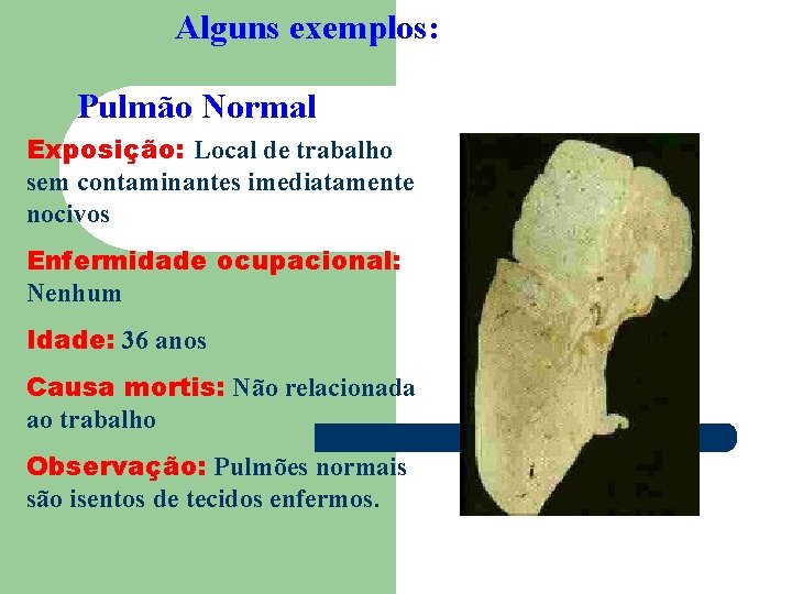 Alguns exemplos: Pulmão Normal Exposição: Local de trabalho sem contaminantes imediatamente nocivos Enfermidade ocupacional: