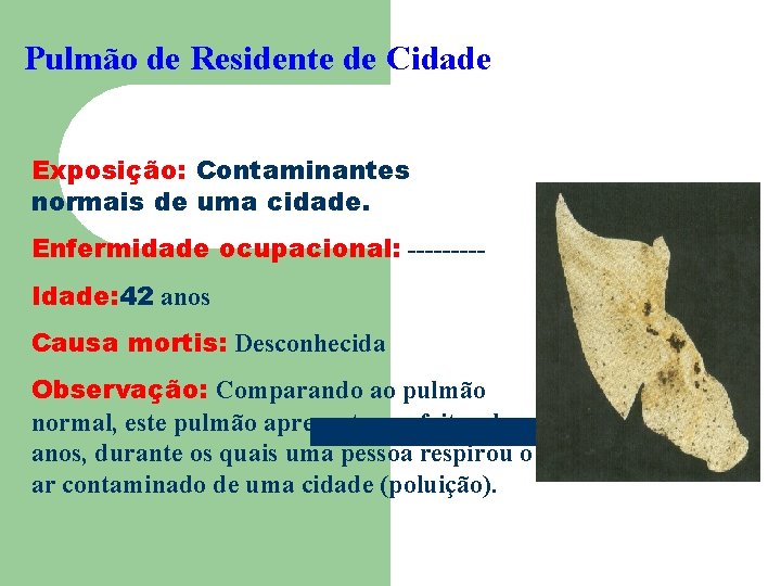 Pulmão de Residente de Cidade Exposição: Contaminantes normais de uma cidade. Enfermidade ocupacional: ----Idade: