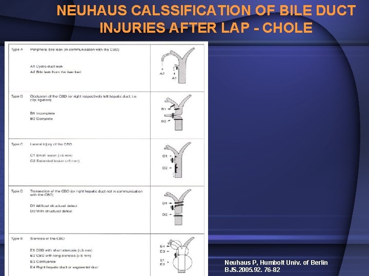 NEUHAUS CALSSIFICATION OF BILE DUCT INJURIES AFTER LAP - CHOLE Neuhaus P, Humbolt Univ.