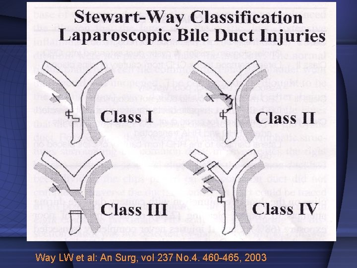 Way LW et al: An Surg, vol 237 No. 4. 460 -465, 2003 
