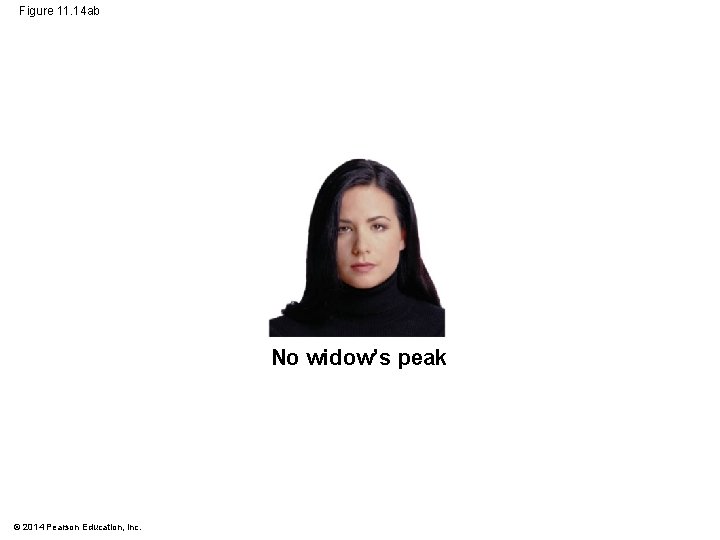 Figure 11. 14 ab No widow’s peak © 2014 Pearson Education, Inc. 