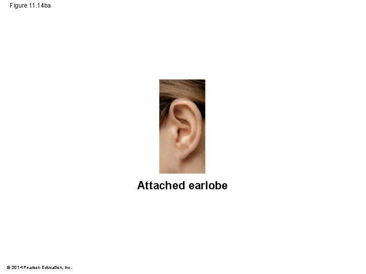 Figure 11. 14 ba Attached earlobe © 2014 Pearson Education, Inc. 