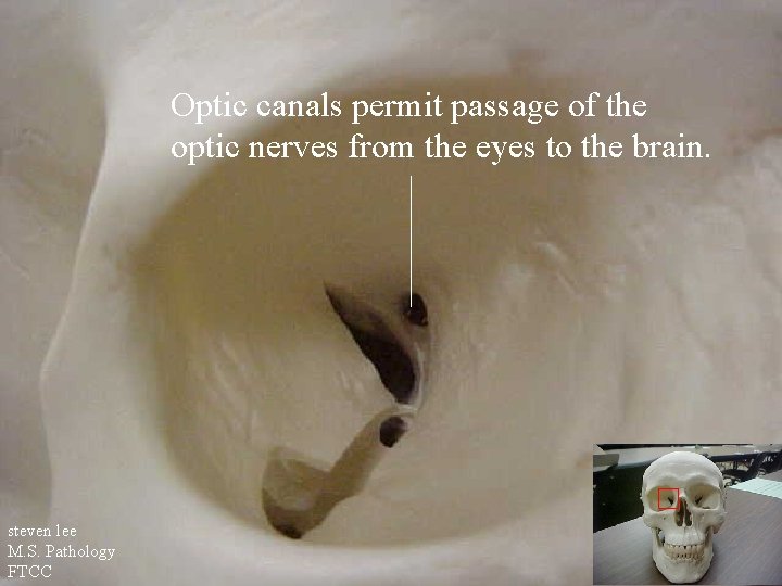 Optic canals permit passage of the optic nerves from the eyes to the brain.