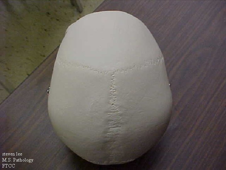 steven lee M. S. Pathology FTCC 