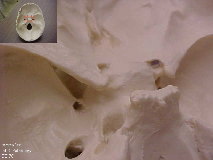 steven lee M. S. Pathology FTCC 