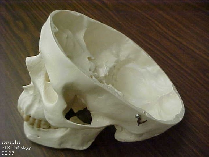 steven lee M. S. Pathology FTCC 