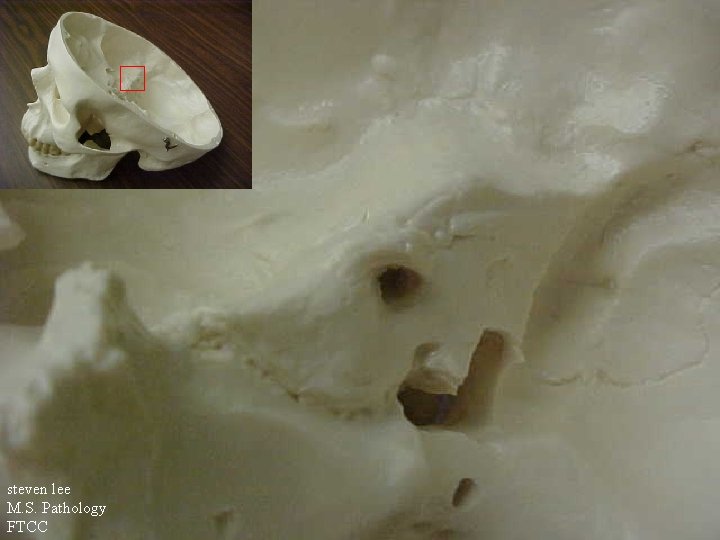 steven lee M. S. Pathology FTCC 