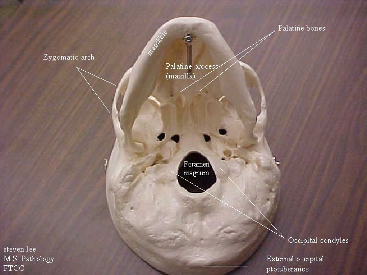 Zygomatic arch ma nd ibl e Palatine bones Palatine process (maxilla) Foramen magnum steven