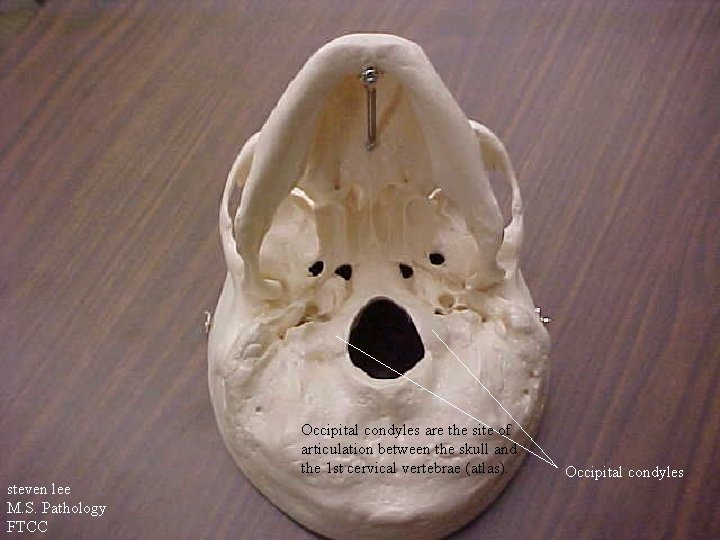 Occipital condyles are the site of articulation between the skull and the 1 st