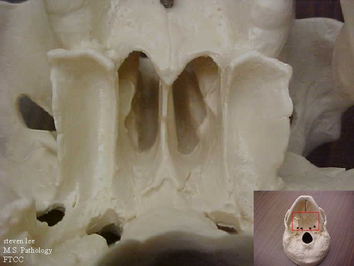 steven lee M. S. Pathology FTCC 