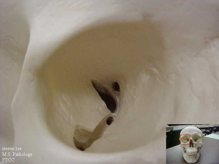 steven lee M. S. Pathology FTCC 