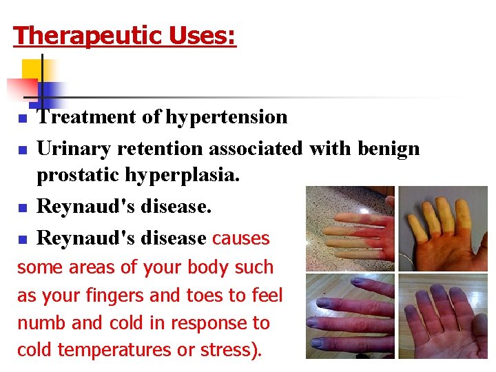 Therapeutic Uses: n n Treatment of hypertension Urinary retention associated with benign prostatic hyperplasia.