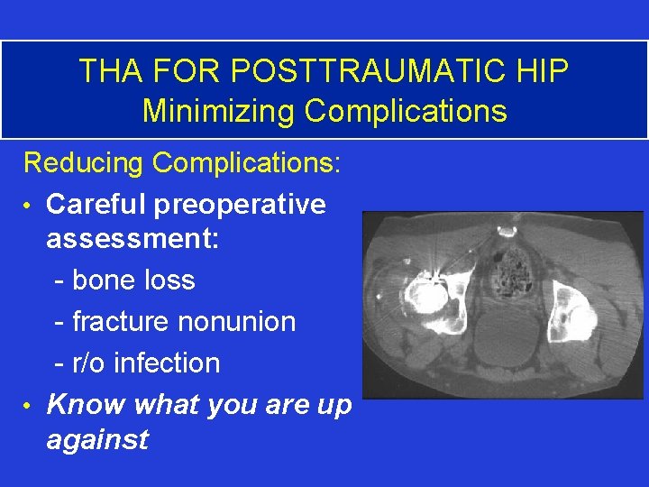 THA FOR POSTTRAUMATIC HIP Minimizing Complications Reducing Complications: • Careful preoperative assessment: - bone