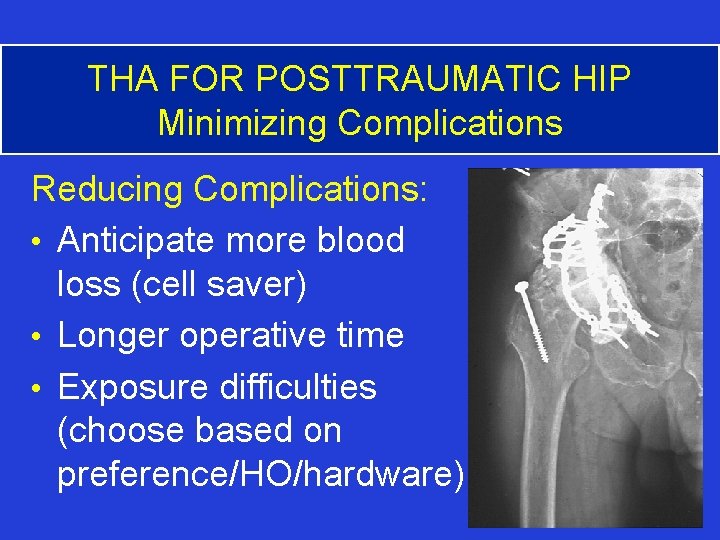 THA FOR POSTTRAUMATIC HIP Minimizing Complications Reducing Complications: • Anticipate more blood loss (cell