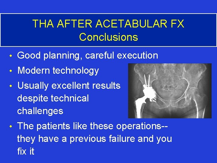 THA AFTER ACETABULAR FX Conclusions • Good planning, careful execution • Modern technology •