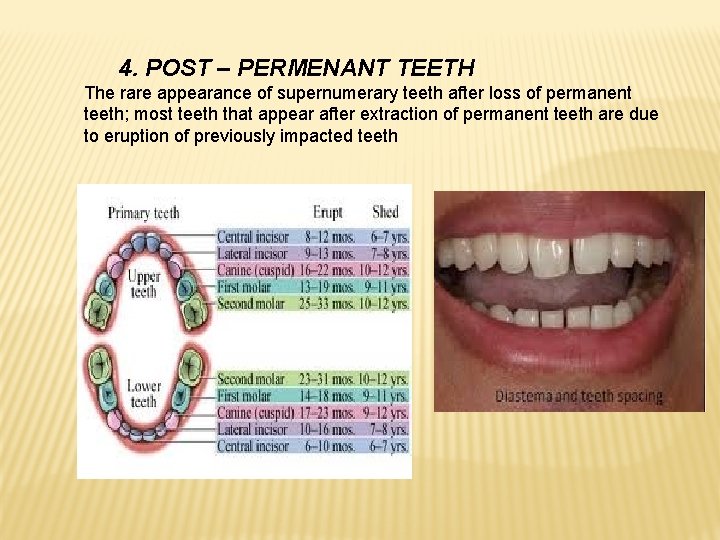 4. POST – PERMENANT TEETH The rare appearance of supernumerary teeth after loss of
