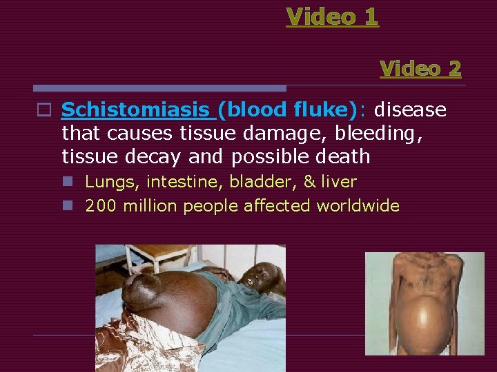 Video 1 Video 2 o Schistomiasis (blood fluke): disease that causes tissue damage, bleeding,