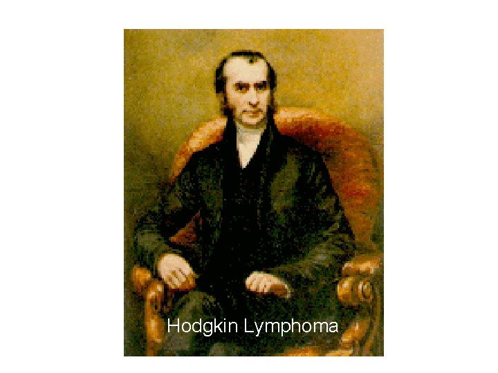 Hodgkin Lymphoma 