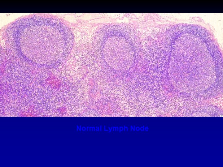 Normal Lymph Node 
