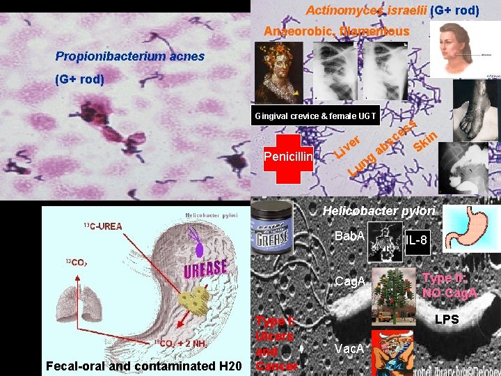 Streptococcus mutans Actinomyces israelii (G+ rod) Anaeorobic, filamentous Propionibacterium acnes (G+ rod) Clostridium difficile